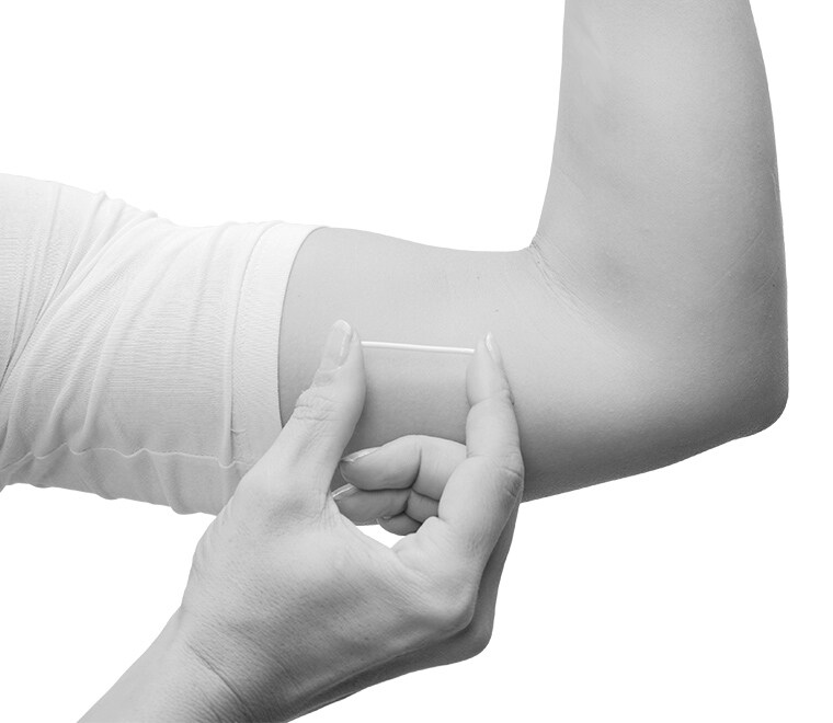 Implant - A skin deep method Implant - A skin deep method